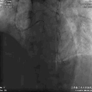 d78e5b7317253e886893b1b17adf38c1.gif