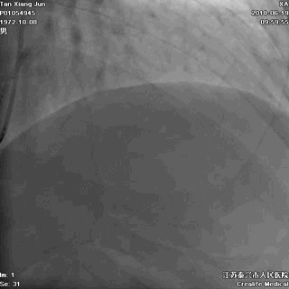 53cf60407fa8b707d0b64fa2d82dcee3.gif