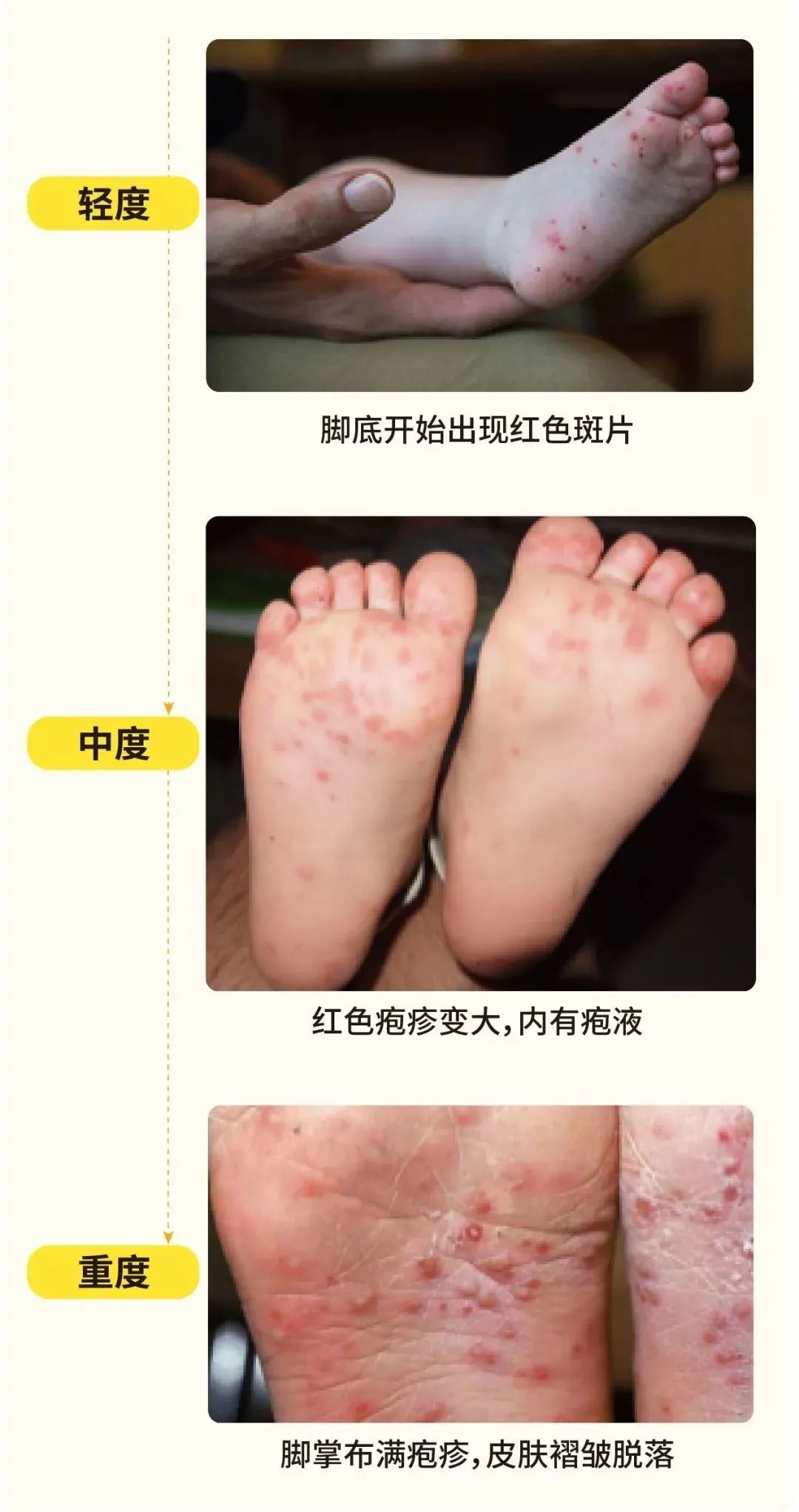 d82e2cb3838a0f9ab13df710310ac1de.jpg